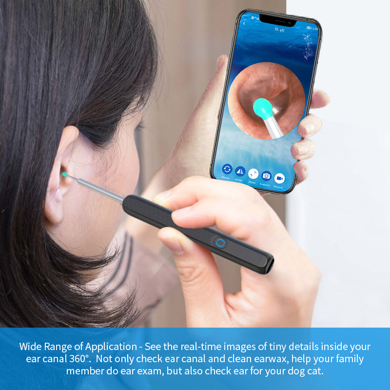 Ear Cleaner, Otoscope, Ear Wax Removal Tool with Camera, LED Light. - Discover Epic Goods
