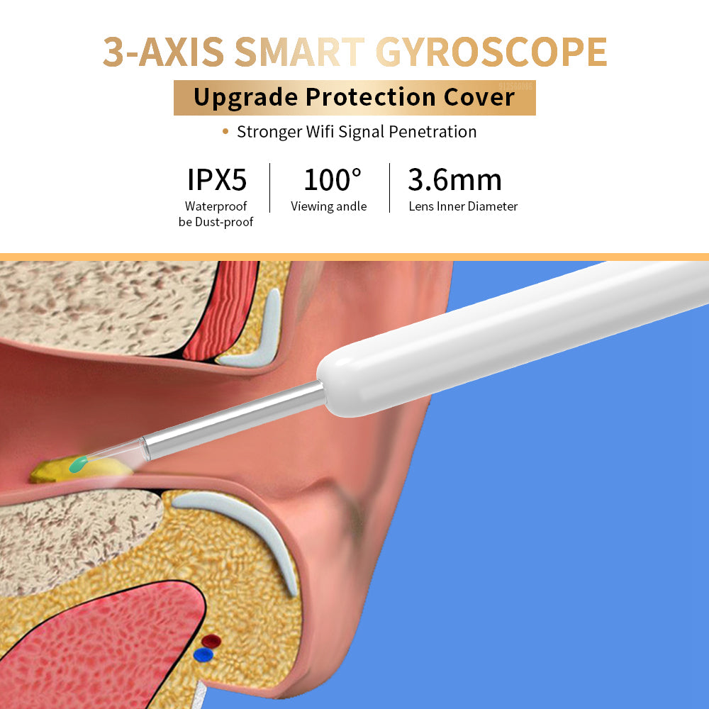 Ear Cleaner, Otoscope, Ear Wax Removal Tool with Camera, LED Light. - Discover Epic Goods