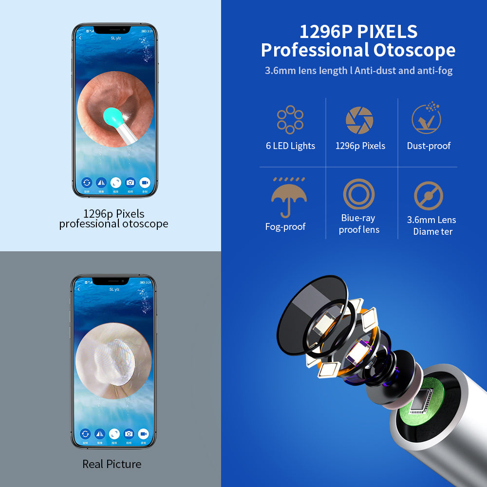 Ear Cleaner, Otoscope, Ear Wax Removal Tool with Camera, LED Light. - Discover Epic Goods